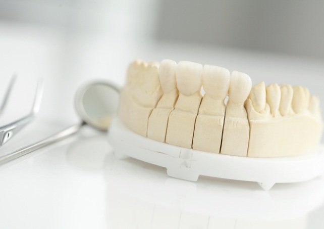 Model smile with dental crown supported fixed bridge