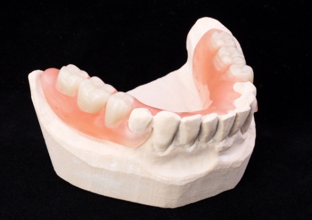 Model smile with partial denture