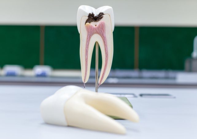 Model of a tooth next to a question mark