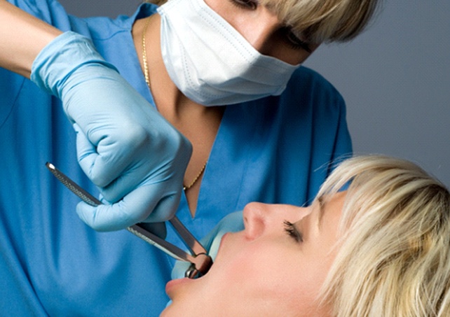 procedure tooth extractions in Virginia Beach