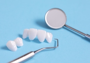 veneers