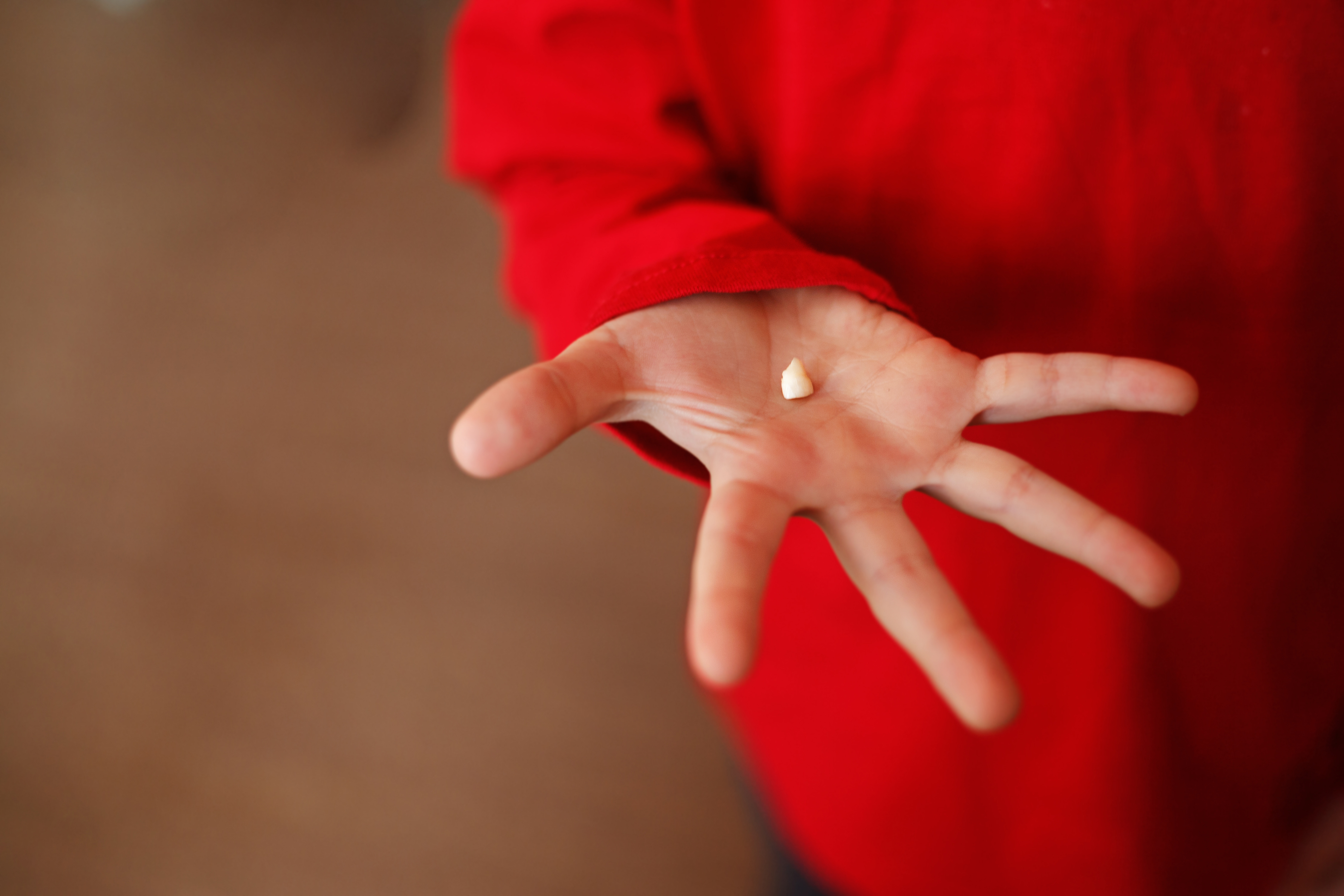 Hand With A Knocked Out Tooth Smile Care Family Dentistry Blog
