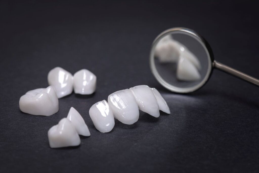 Closeup of several veneers reflected in dental mirror on black surface