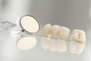 Your Virginia Beach dentist places tooth-colored fillings.